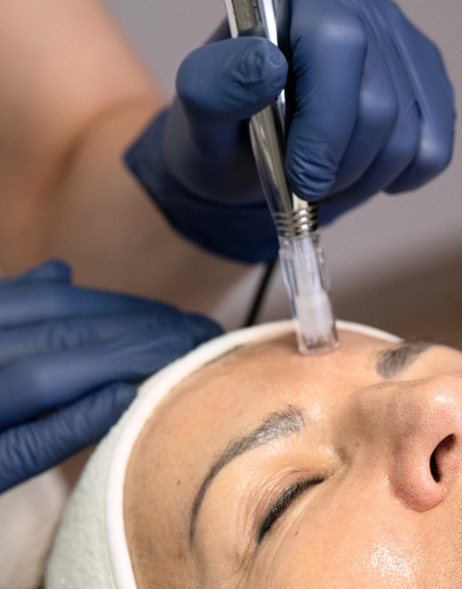 Dermapen mikrotűs kezelések a bőröd egységesebb felszínéért és a feszesebb kontúrokért.